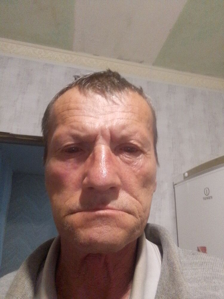  38179701  , 64 ,    