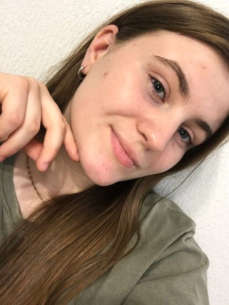  44873901  Adelina, 19 ,    