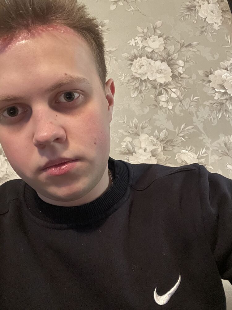  38933181  , 23 ,    