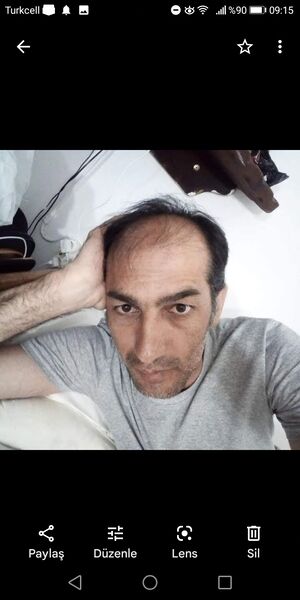  Tetovo,   Caferdemir, 44 ,   ,   