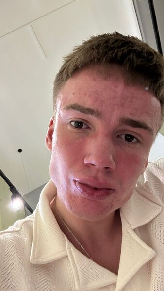  Lomianki,   , 20 ,   ,   