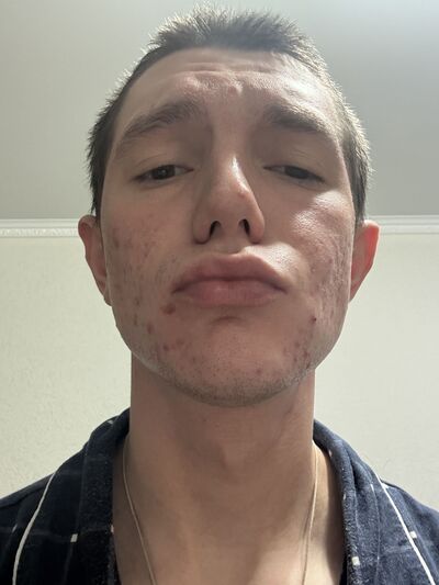  --,   , 22 ,   ,   