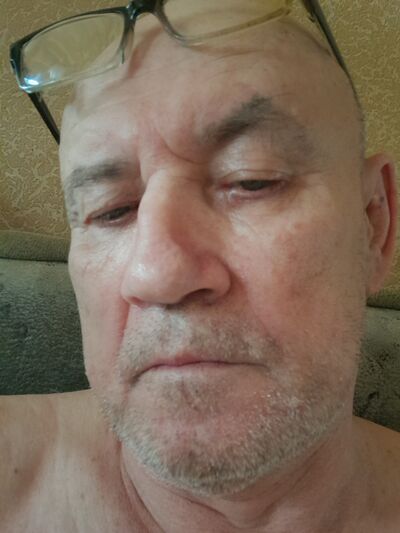 ,   , 65 ,   ,   